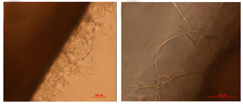 Biomimetic and vascularized 3D liver cancer model